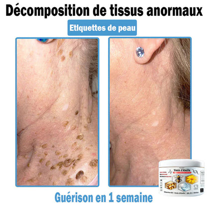 Trilumia®🥥30% de réduction supplémentaire