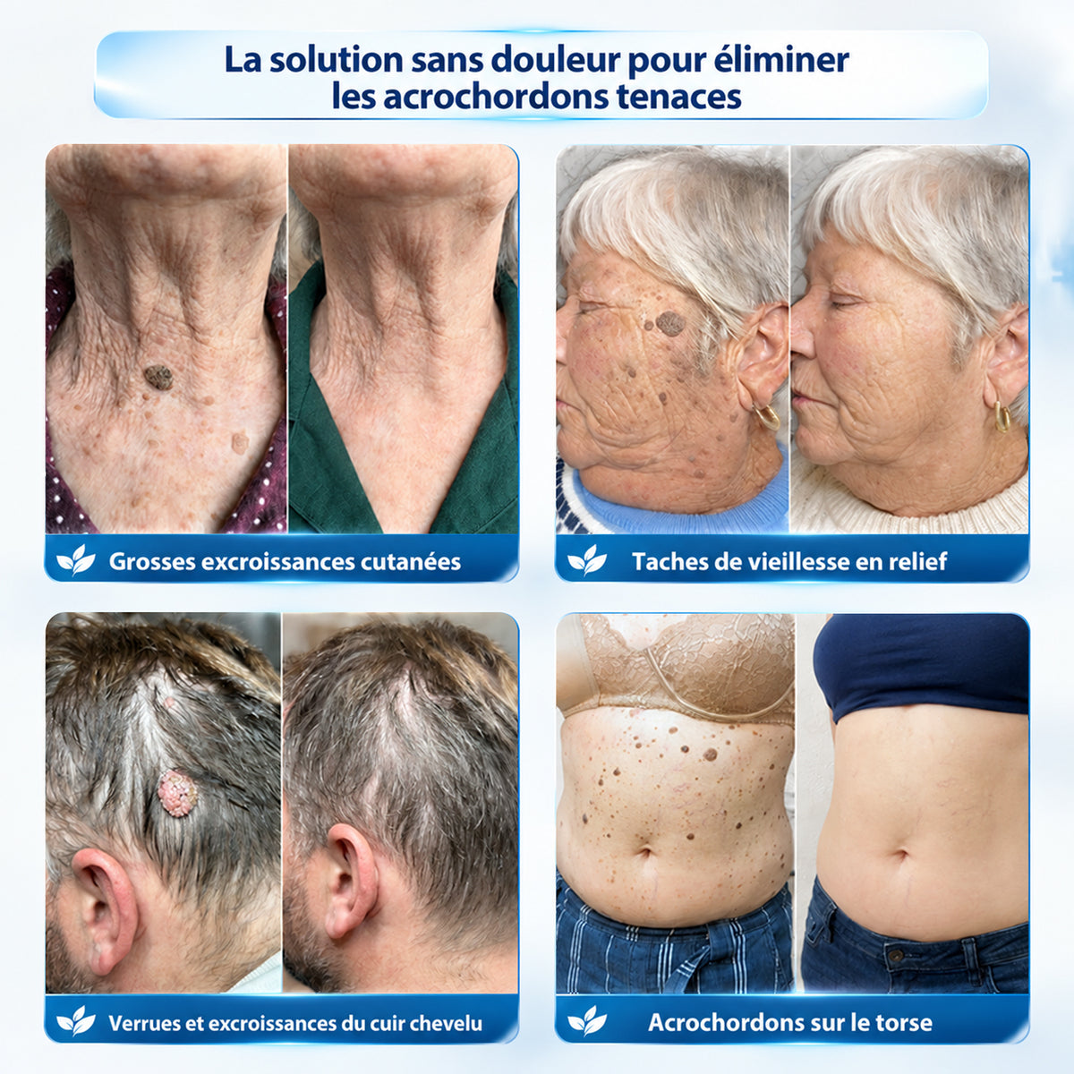 Dyceco® 🍁 𝐂𝐫è𝐦𝐞 𝐄𝐟𝐟𝐚𝐜𝐞𝐮𝐫 𝐝’𝐀𝐜𝐫𝐨𝐜𝐡𝐨𝐫𝐝𝐨𝐧𝐬 & 𝐝𝐞 𝐓𝐚𝐜𝐡𝐞𝐬 – 𝟕 𝐉𝐨𝐮𝐫𝐬(𝐅𝐨𝐫𝐦𝐮𝐥𝐞 𝐙é𝐫𝐨 𝐃𝐨𝐮𝐥𝐞𝐮𝐫, 𝐙é𝐫𝐨 𝐂𝐢𝐜𝐚𝐭𝐫𝐢𝐜𝐞)