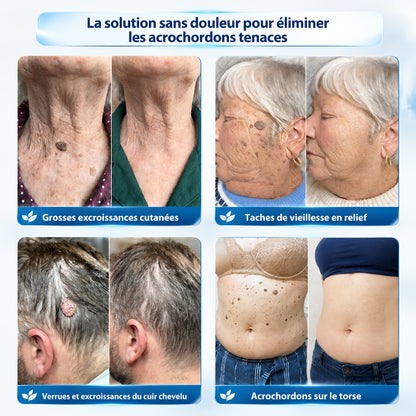 Dyceco® 🍁 𝐂𝐫è𝐦𝐞 𝐄𝐟𝐟𝐚𝐜𝐞𝐮𝐫 𝐝’𝐀𝐜𝐫𝐨𝐜𝐡𝐨𝐫𝐝𝐨𝐧𝐬 & 𝐝𝐞 𝐓𝐚𝐜𝐡𝐞𝐬 – 𝟕 𝐉𝐨𝐮𝐫𝐬(𝐅𝐨𝐫𝐦𝐮𝐥𝐞 𝐙é𝐫𝐨 𝐃𝐨𝐮𝐥𝐞𝐮𝐫, 𝐙é𝐫𝐨 𝐂𝐢𝐜𝐚𝐭𝐫𝐢𝐜𝐞)