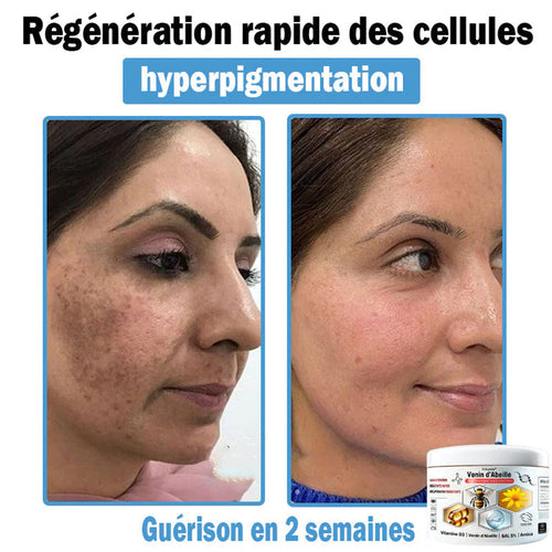 Trilumia®🥥30% de réduction supplémentaire