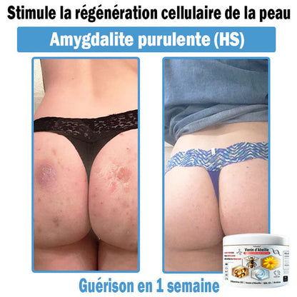 Trilumia®🥥30% de réduction supplémentaire
