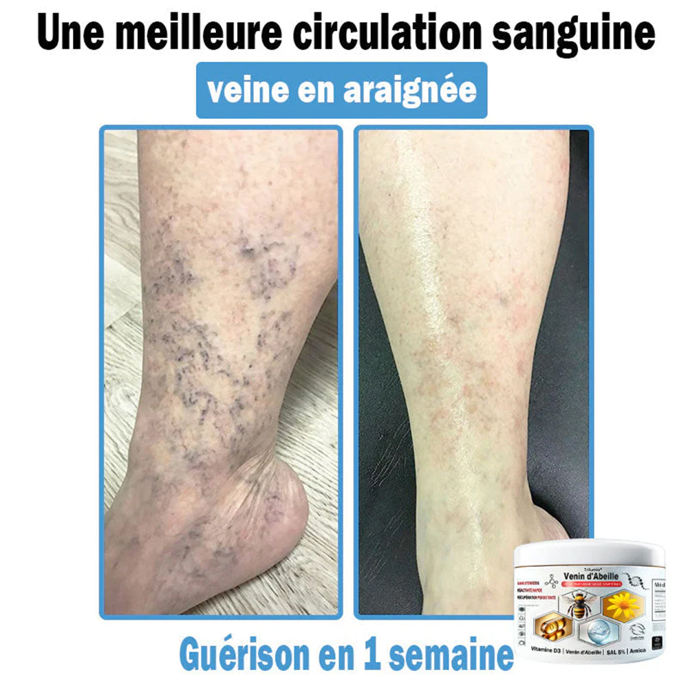 Trilumia®🥥30% de réduction supplémentaire