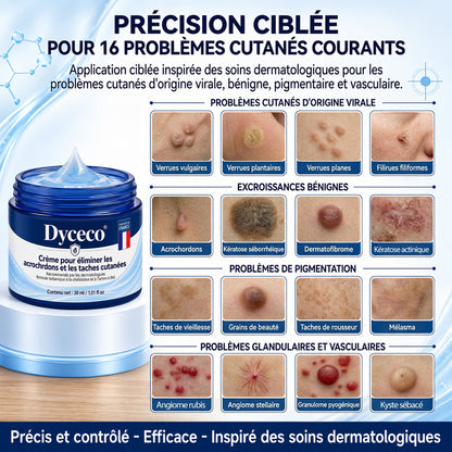 Dyceco® 🍁 𝐂𝐫è𝐦𝐞 𝐄𝐟𝐟𝐚𝐜𝐞𝐮𝐫 𝐝’𝐀𝐜𝐫𝐨𝐜𝐡𝐨𝐫𝐝𝐨𝐧𝐬 & 𝐝𝐞 𝐓𝐚𝐜𝐡𝐞𝐬 – 𝟕 𝐉𝐨𝐮𝐫𝐬(𝐅𝐨𝐫𝐦𝐮𝐥𝐞 𝐙é𝐫𝐨 𝐃𝐨𝐮𝐥𝐞𝐮𝐫, 𝐙é𝐫𝐨 𝐂𝐢𝐜𝐚𝐭𝐫𝐢𝐜𝐞)