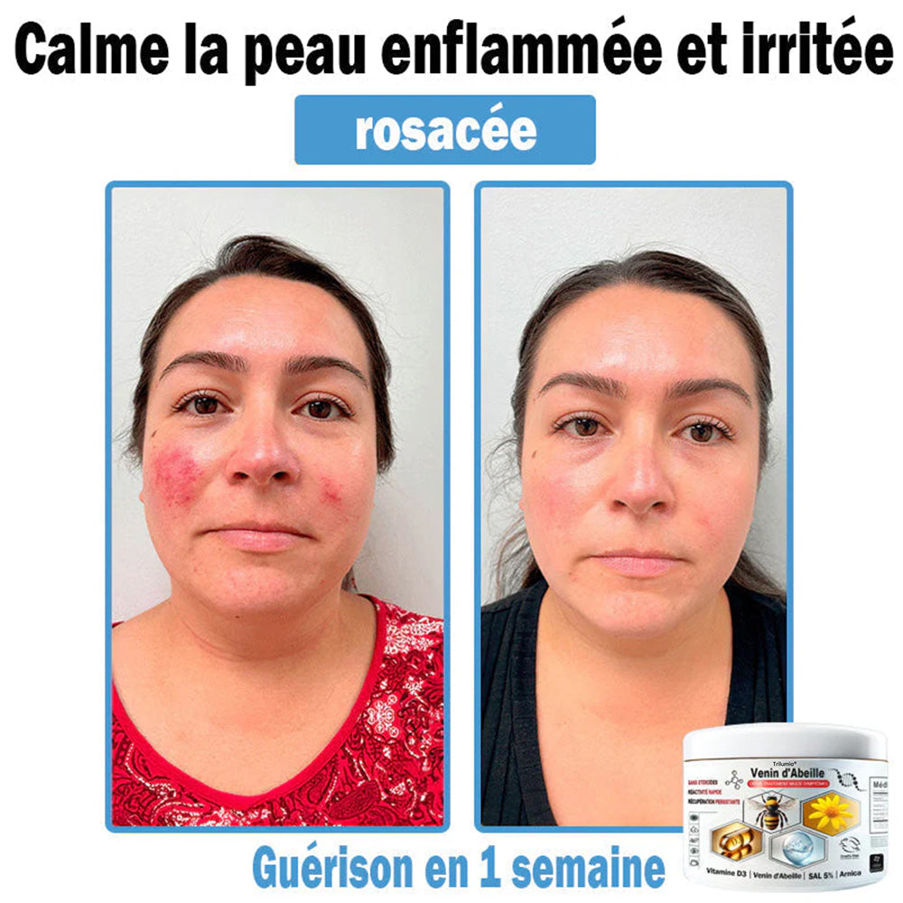 2 Pots⭐️Soulagement instantané