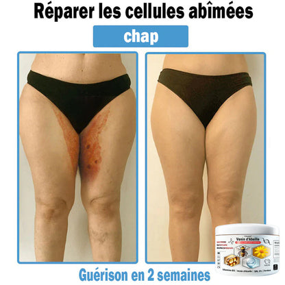 Trilumia®🥥30% de réduction supplémentaire