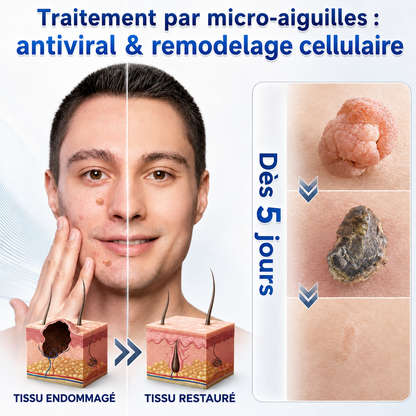 👩‍⚕️💕 𝐵𝑜𝑢𝑡𝑖𝑞𝑢𝑒 𝑂𝑓𝑓𝑖𝑐𝑖𝑒𝑙𝑙𝑒 | Dyceco® 🚑𝑴𝒊𝒄𝒓𝒐𝒏𝒆𝒆𝒅𝒍𝒆𝒔 𝑷𝒆𝒂𝒖 𝑷𝒂𝒓𝒇𝒂𝒊𝒕𝒆 É𝒍𝒊𝒎𝒊𝒏𝒂𝒕𝒊𝒐𝒏 𝑫𝒆𝒔 𝑽𝒆𝒓𝒓𝒖𝒆𝒔 𝑷𝒂𝒕𝒄𝒉 (𝑃𝑜𝑢𝑟 𝑙𝑒𝑠 𝑎𝑐𝑟𝑜𝑐ℎ𝑜𝑟𝑑𝑜𝑛𝑠, 𝑙𝑒𝑠 𝑝𝑒𝑡𝑖𝑡𝑒𝑠 𝑒𝑥𝑐𝑟𝑜𝑖𝑠𝑠𝑎𝑛𝑐𝑒𝑠 𝑐𝑢𝑡𝑎𝑛é𝑒𝑠, 𝑙𝑒𝑠 𝑣𝑒𝑟𝑟𝑢𝑒𝑠, 𝑙𝑒𝑠 𝑔𝑟𝑎𝑖𝑛𝑠 𝑑𝑒 𝑏𝑒𝑎𝑢𝑡é, 𝑙𝑒𝑠 𝑡𝑎𝑐ℎ𝑒𝑠 𝑑𝑒 𝑣𝑖𝑒𝑖𝑙𝑙𝑒𝑠𝑠𝑒 𝑒𝑡 𝑙𝑒𝑠 𝑝𝑟𝑜𝑏𝑙è𝑚𝑒𝑠 𝑑𝑒 𝑝𝑖𝑔𝑚𝑒𝑛𝑡𝑎𝑡𝑖𝑜𝑛)